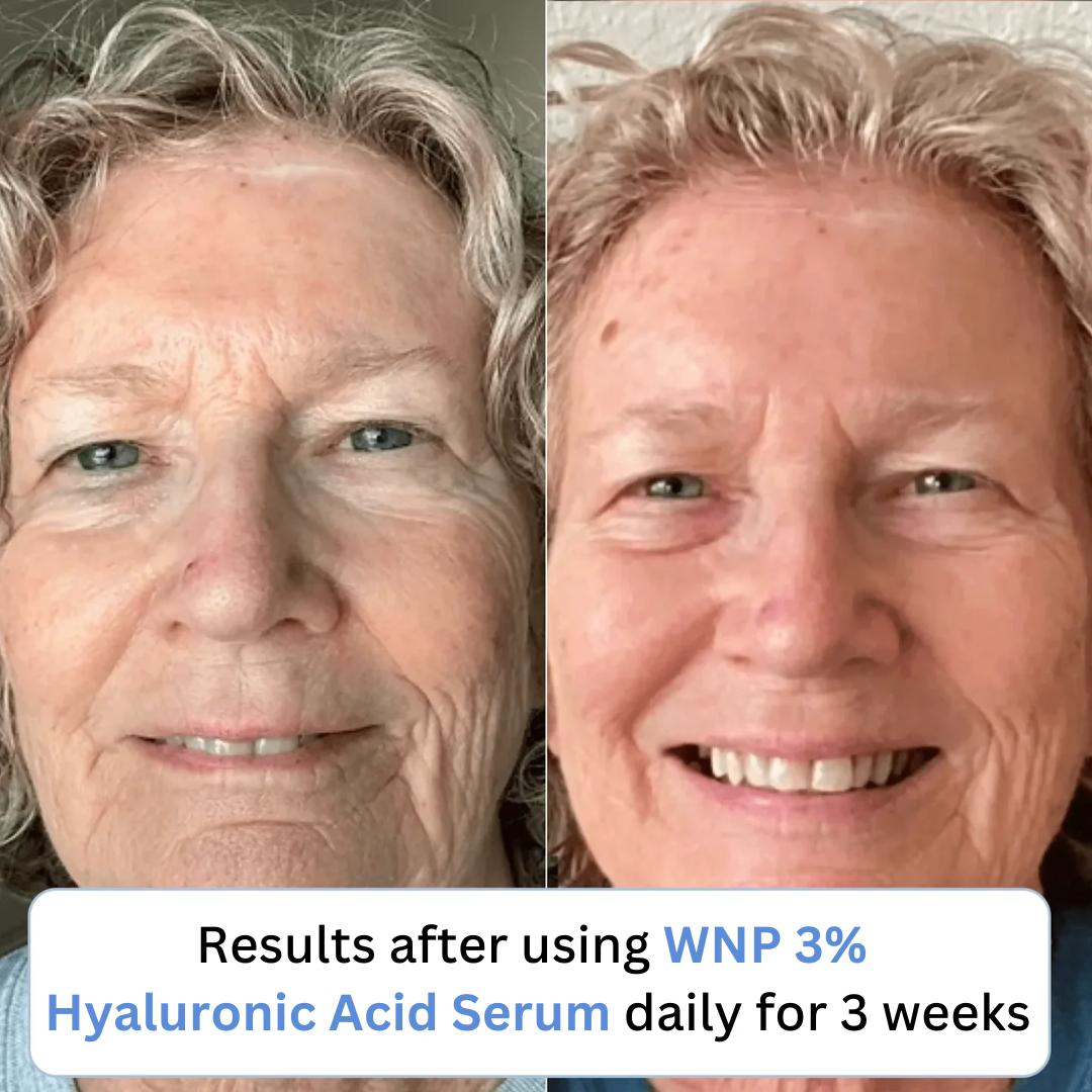 WNP 3% Ultra Hydrating Hyaluronic Acid Serum